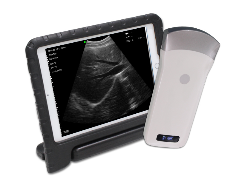 3C convex palm B/W ultrasound