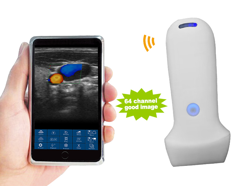 8L linear palm doppler ultrasound