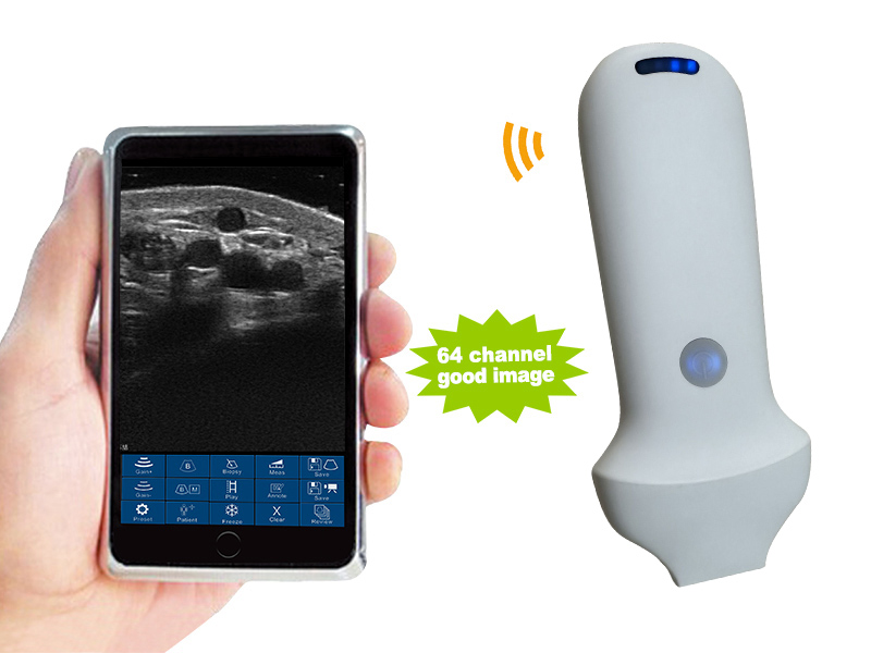 8P linear palm doppler ultrasound