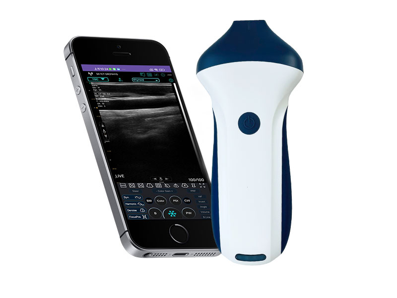 7S linear palm doppler ultraso