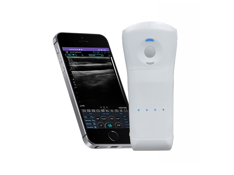 9CPL Replaceable Battery 3in1 palm doppler ultrasound scanner(VIP Exclusive)