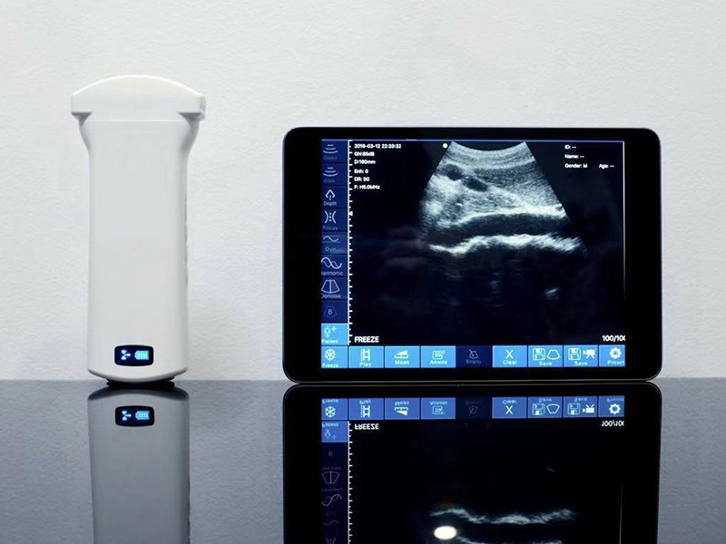 Clinical Procurement Guide for Sonostar Portable Ultrasound Diagnostic Devices Clinical Procurement Guide for Sonostar Portable Ultrasound Diagnostic Devices