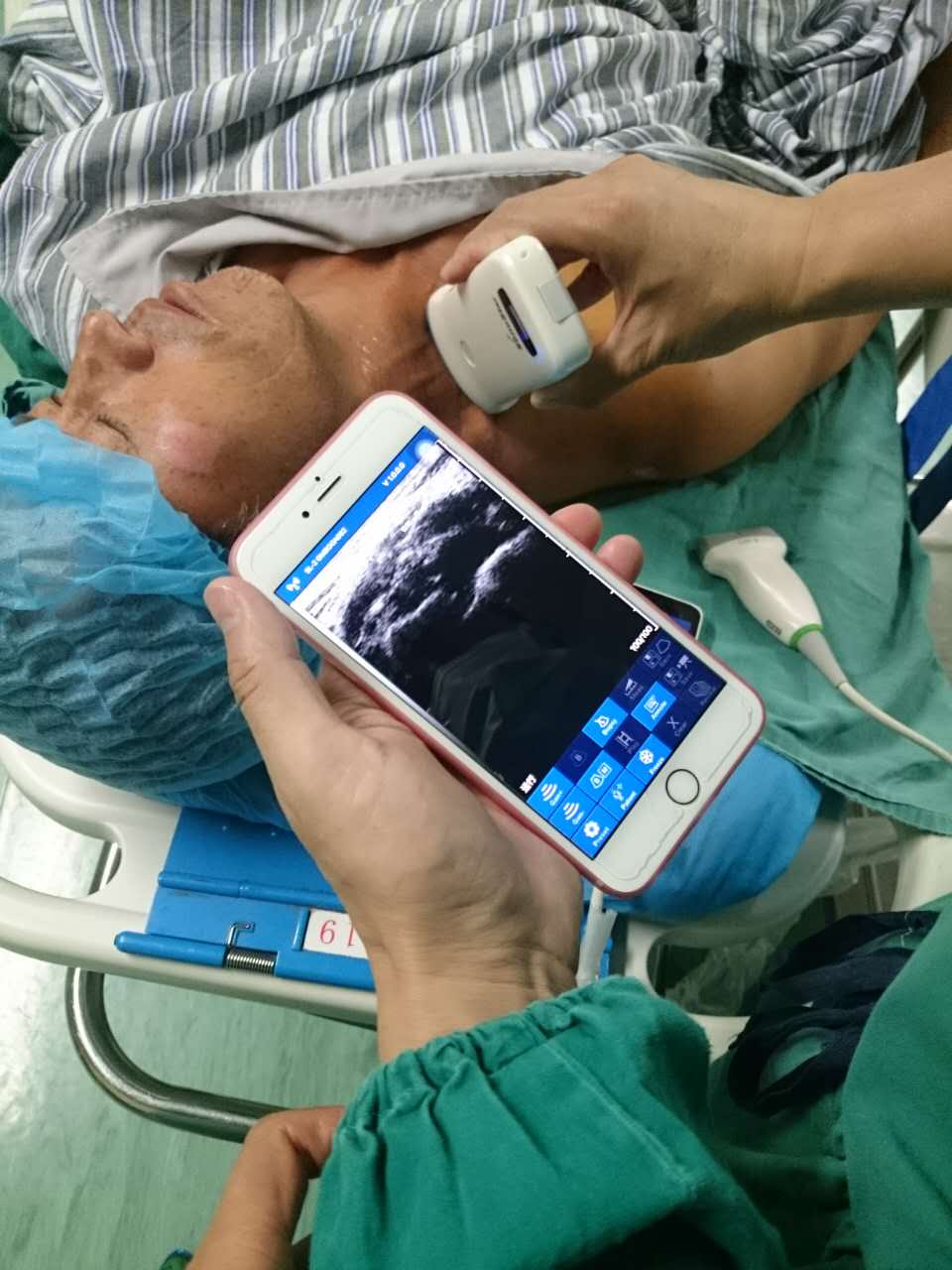 How to Choose a Cost‑Effective Wireless Handheld Ultrasound for Hospital Procurement How to Choose a Cost‑Effective Wireless Handheld Ultrasound for Hospital Procurement