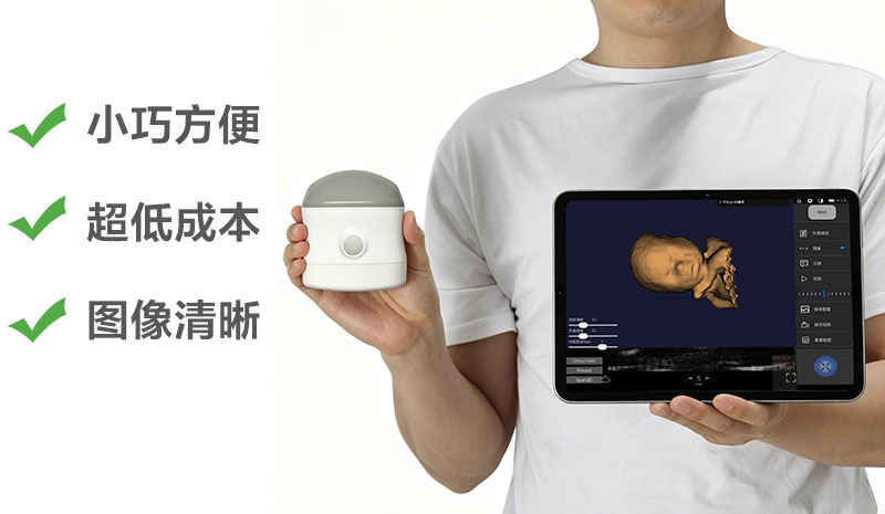 凸阵 vs 线索诺星4D立体成像掌上超声:哪种适合你的科室 凸阵 vs 线索诺星4D立体成像掌上超声:哪种适合你的科室